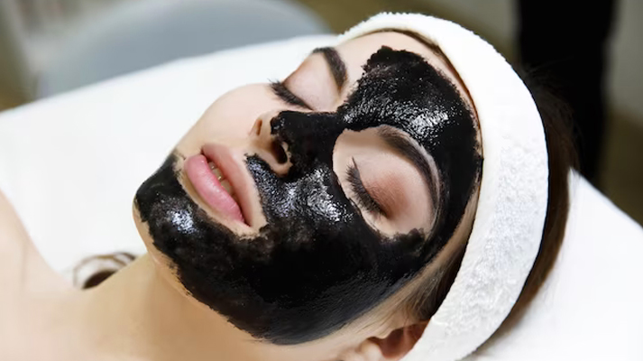 Carbon peel (Hollywood peel)